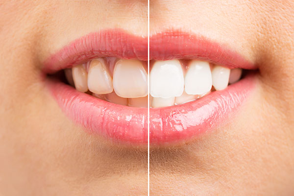 Cosmetic Dentist